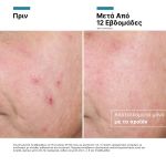 SkinCeuticals Advanced RGN-6 Προηγμένη Κρέμα Ανάπλασης Αντιγήρανσης